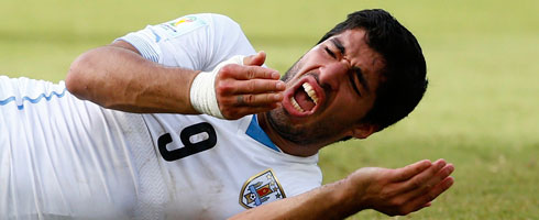 suarez-teeth490ai[1]